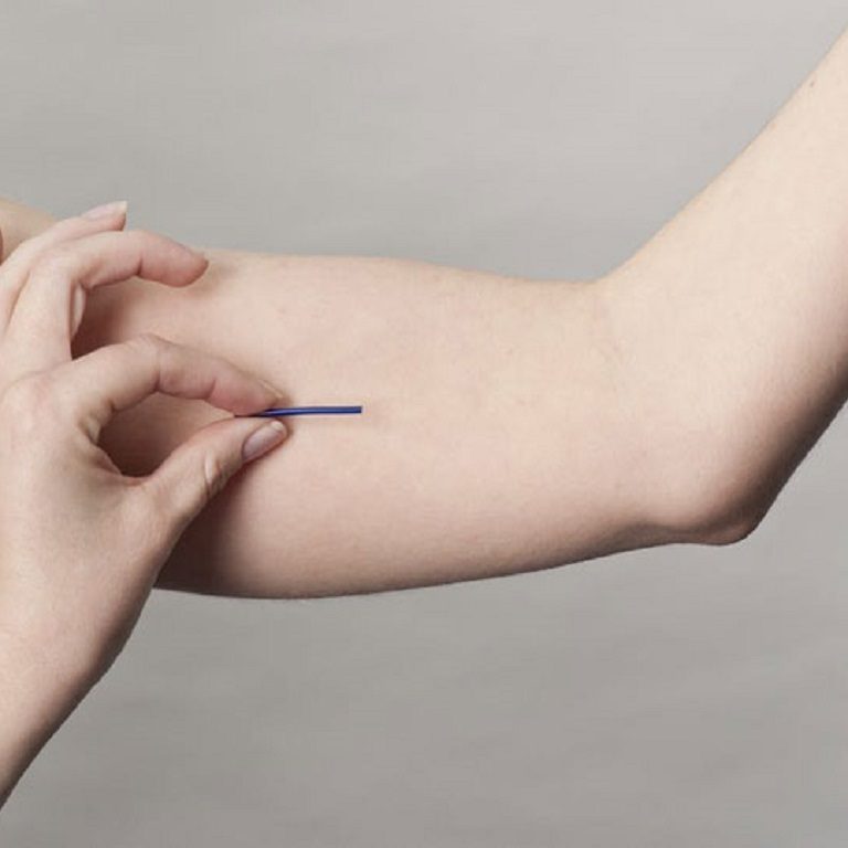 deri-alti-implant-uygulamasi_1692000982