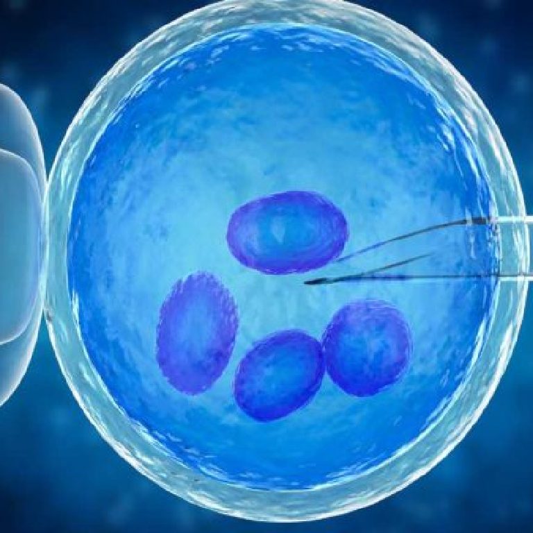 mikro-tese-ameliyati-i-le-klinefelter-sendromu-tedavisi_1692009369