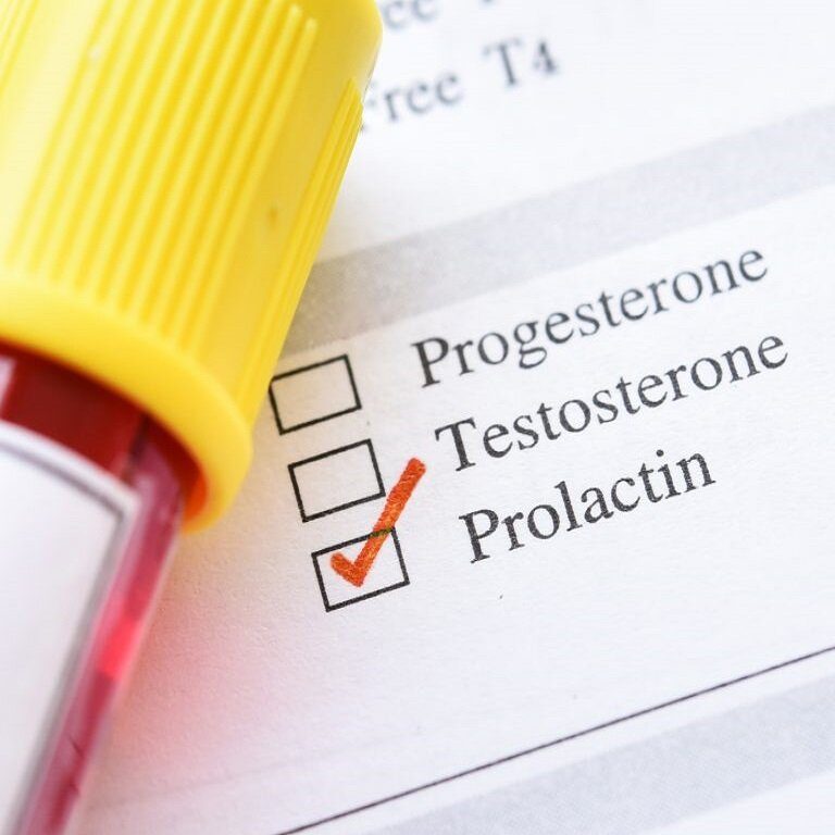 sut-hormonu-yuksekligi_1692001759