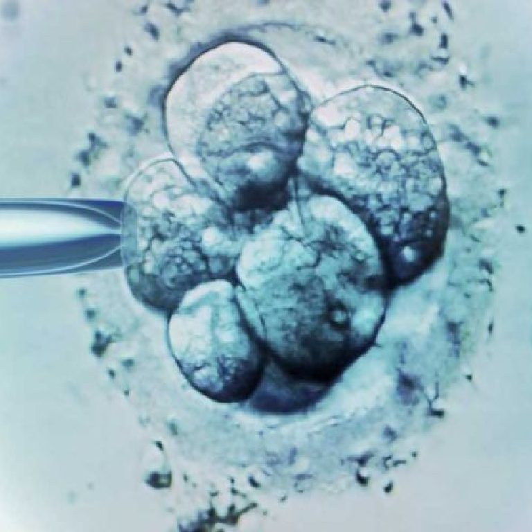 tikaniklig-a-bag-li-olmayan-azospermi_1692004367