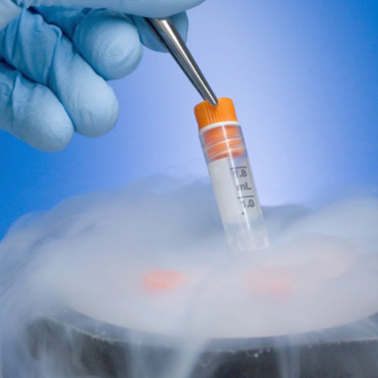 yumurta-dondurma_1692000274